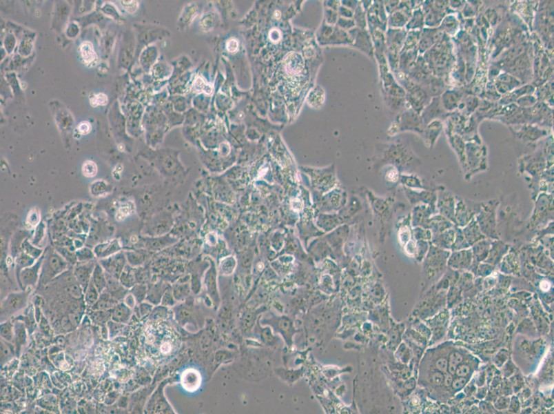 OV-90 Cell Complete Medium - 6