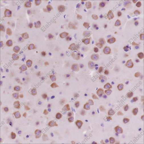Recombinant Dynamin 1 Monoclonal Antibody - 3