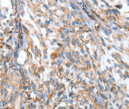 APOBEC3D Polyclonal Antibody - 3