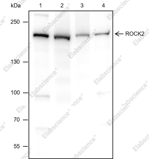Recombinant ROCK2 Monoclonal Antibody - 2
