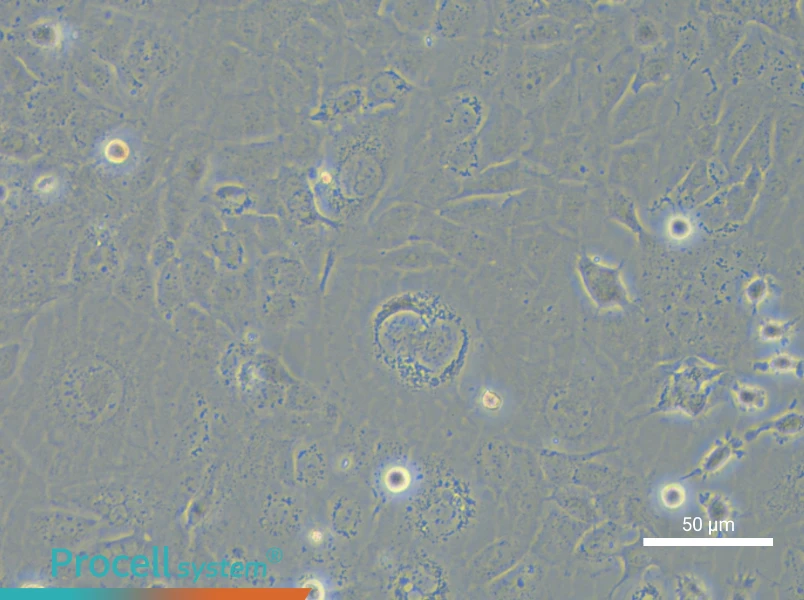 NCI-H1838 - 4