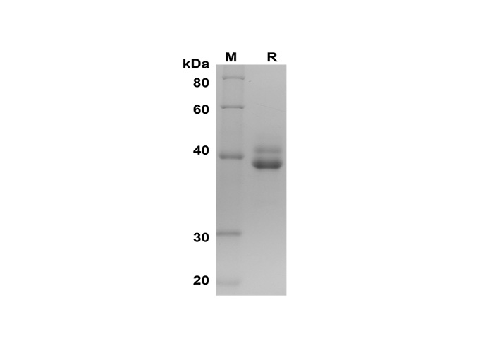 Recombinant Mouse RETN Protein(Trx Tag)-产品推荐-1