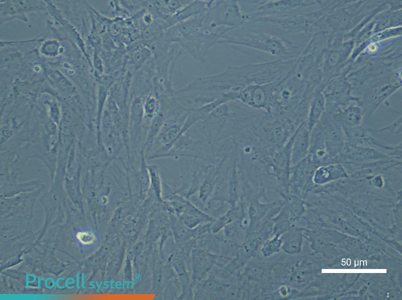 Mouse Brain Microvascular Pericyte Complete Medium - small - 6