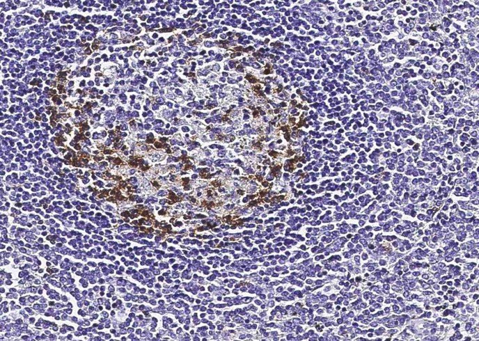 Recombinant PD1/PDCD1/CD279 Monoclonal Antibody - small - 2