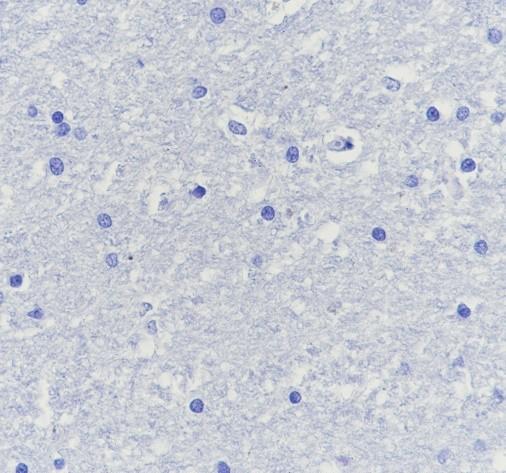 Recombinant CPT1B Monoclonal Antibody - small - 4