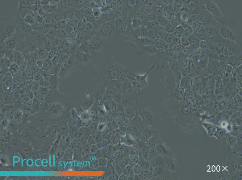 Ca Ski Cell Complete Medium - small - 6