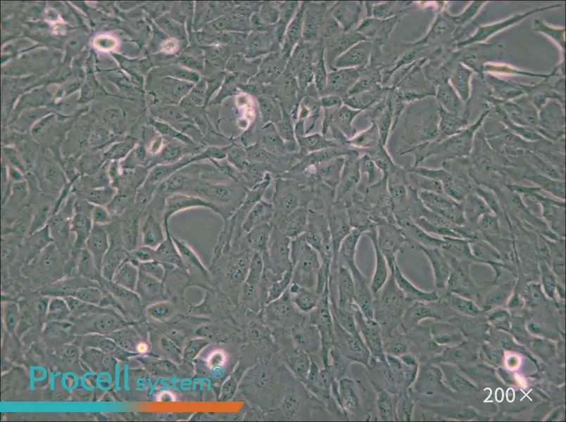 Calu-1 Cell Complete Medium - small - 5