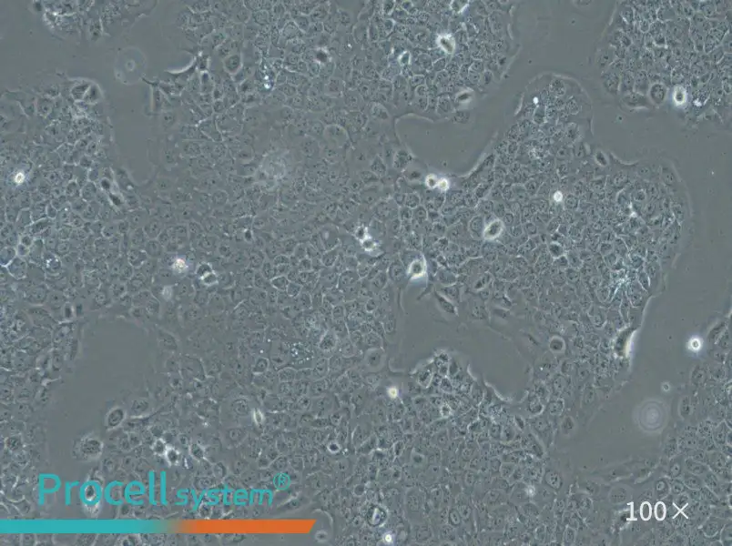 Ca Ski Cell Complete Medium - 1
