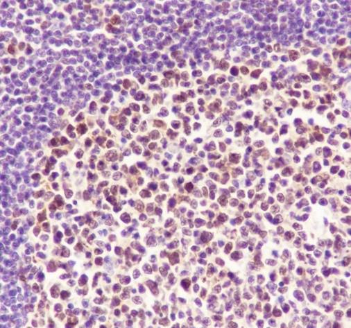 Recombinant FEN1 Monoclonal Antibody - 2