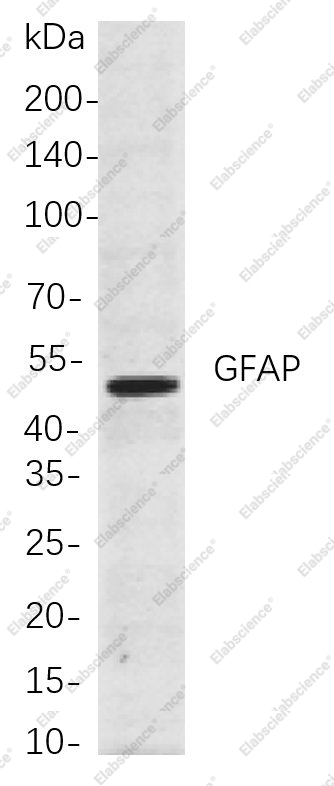 Recombinant GFAP Monoclonal Antibody - 1