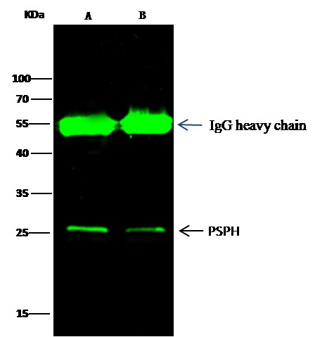 Recombinant PSPH Monoclonal Antibody - small - 2
