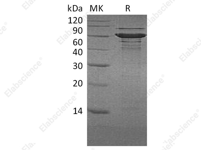Recombinant Human BLNK/Ly-57 Protein (His Tag) - 1
