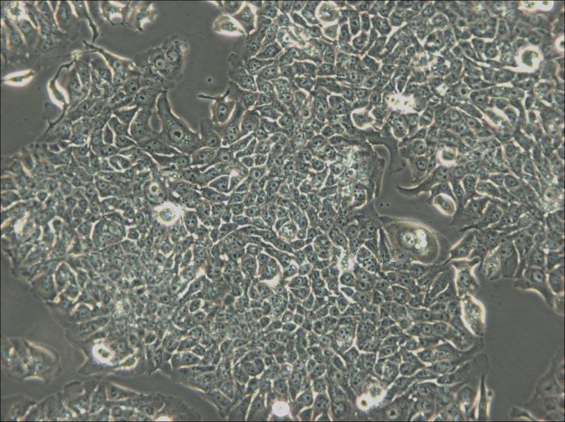 JIMT-1 Cell Complete Medium - 6