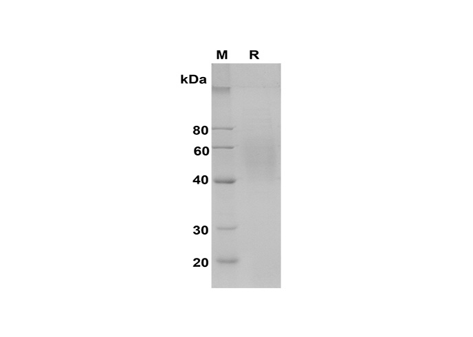 Recombinant Mouse IL-15 Protein(Sumo Tag)-产品推荐-1