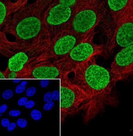Recombinant FOXA1 Monoclonal Antibody - 3