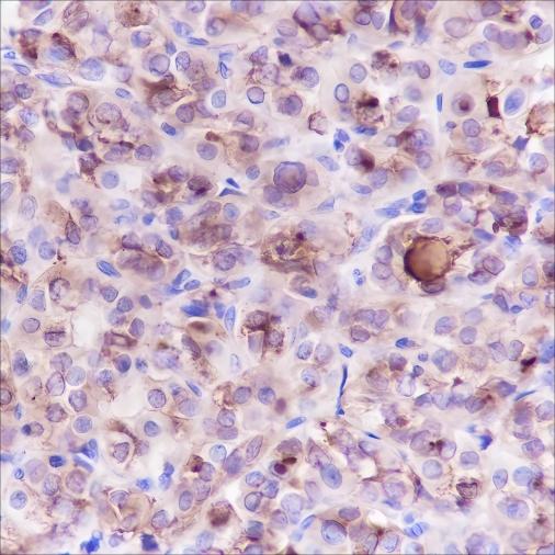 Recombinant Thyroglobulin Monoclonal Antibody-searchlist-1