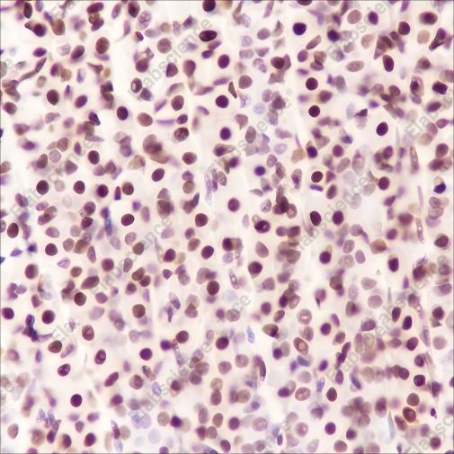 Recombinant FUBP1 Monoclonal Antibody - 5
