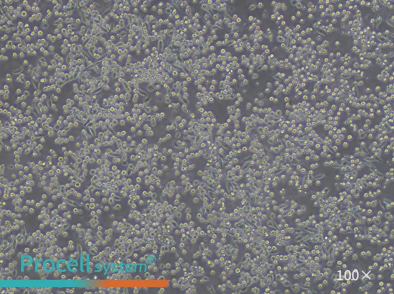 P815 Cell Complete MediumP815 Cell Complete Medium - 3