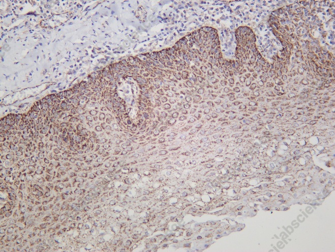 Recombinant MAO-A Monoclonal Antibody - 2