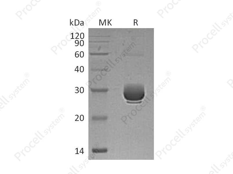 ANGPTL3 (Ser17-Thr206) (C-6His), Mouse, Recombinant