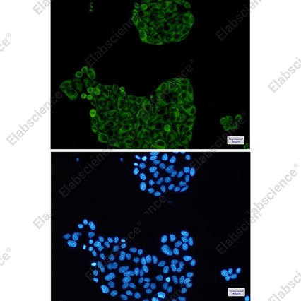 Recombinant PFKP Monoclonal Antibody - 2