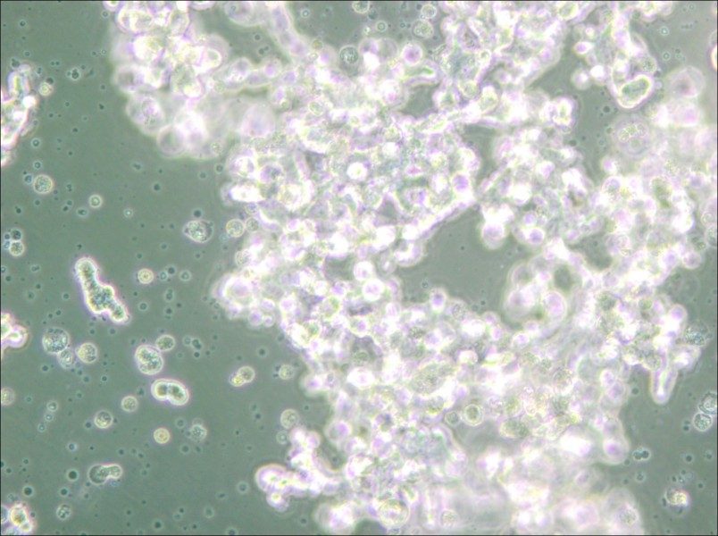 DU4475 Cell Complete Medium - 6