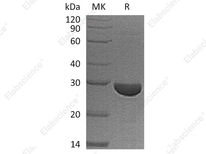 Recombinant Human S100A13 Protein - 1