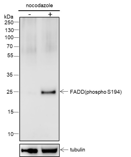 Recombinant Phospho-FADD (S194) Monoclonal Antibody-searchlist-1