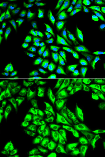 Immunofluorescence analysis of HeLa cells using EEF1A1 Polyclonal Antibody