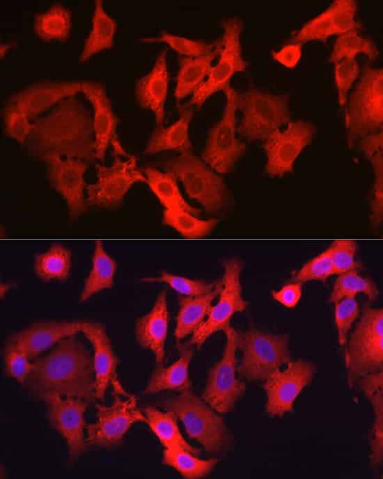 Immunofluorescence analysis of A-549 cells using GPX4 Polyclonal Antibody at dilution of 1:200 (40x lens). Blue: DAPI for nuclear staining.