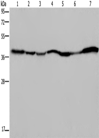 Western Blot analysis of 293T and Hela cell, Human fetal liver, Mouse spleen and heart tissue, Human fetal brain and hepatocellular carcinoma tissue  using GOT2 Polyclonal Antibody at dilution of 1:400