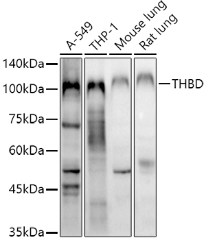 Western blot analysis of extracts of various cell lines using CD141/Thrombomodulin Polyclonal Antibody at 1:1000 dilution.