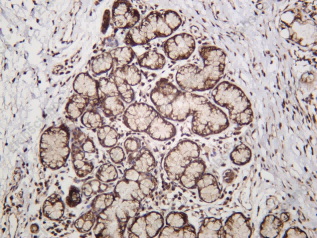 Recombinant FGFR-3 Monoclonal Antibody - 1
