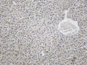 Recombinant CD155 Monoclonal Antibody - 1