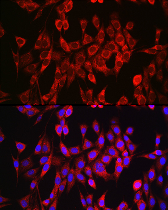 Immunofluorescence analysis of NIH/3T3 cells using Glutaminase (GLS) Polyclonal Antibody at dilution of 1:150. Blue: DAPI for nuclear staining.