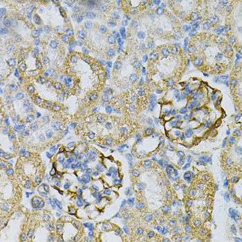 Immunohistochemistry of paraffin-embedded rat kidney using AK1 Polyclonal Antibody at dilution of 1:100 (40x lens).Perform microwave antigen retrieval with 10 mM PBS buffer pH 7.2 before commencing with IHC staining protocol.