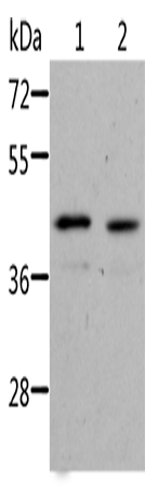 Western Blot analysis of Jurkat cell and Human fetal kidney tissue using NIF3L1 Polyclonal Antibody at dilution of 1:500