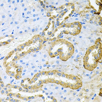 Immunohistochemistry of paraffin-embedded Rat kidney using ABL1 Polyclonal Antibody at dilution of 1:100 (40x lens).