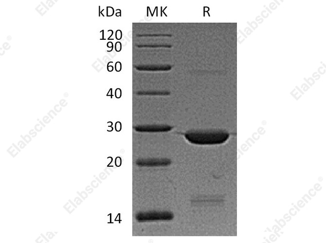 Recombinant Human BAG2 Protein (His Tag) - 1