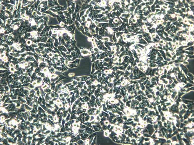 SK-CO-1 Cell Complete Medium - 5