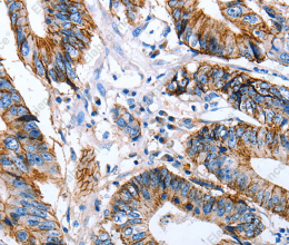 Claudin 7 Polyclonal Antibody - 2