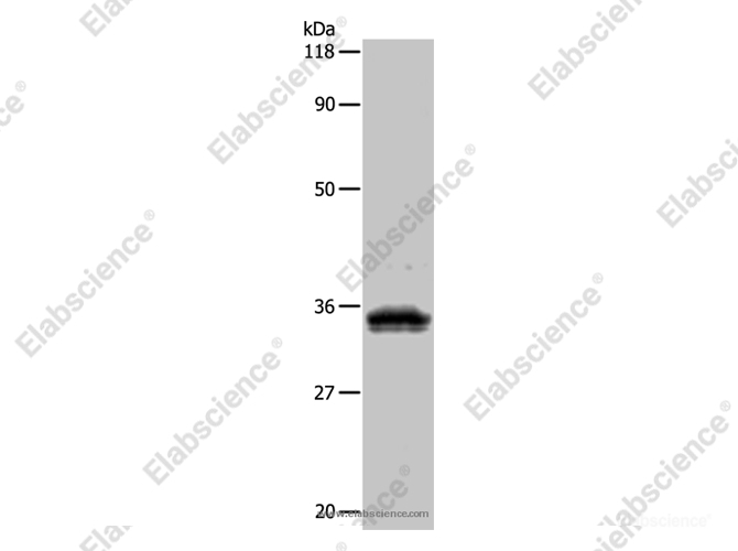 UPK3B Polyclonal Antibody - 1