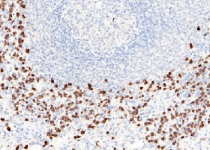Recombinant S100A8 Monoclonal Antibody - small - 1