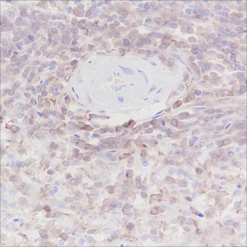 Recombinant ARPC5/p16 ARC Monoclonal Antibody - 2