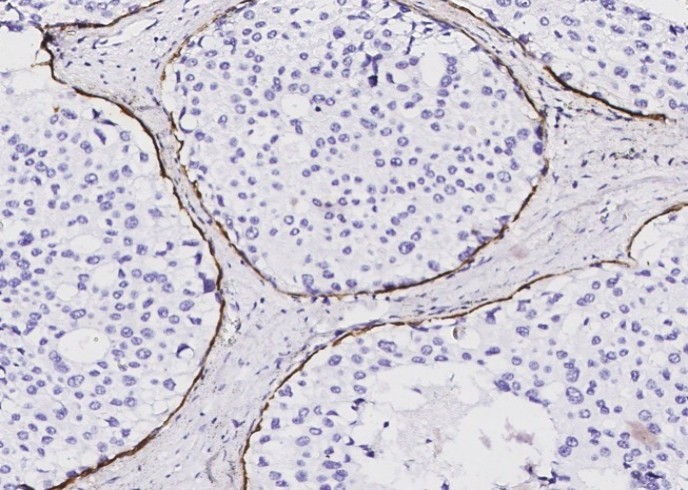 Recombinant KRT5 Monoclonal Antibody - small - 3