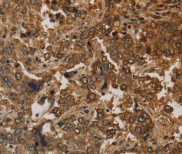 CK-16 Polyclonal Antibody - 3