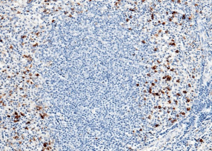 Recombinant CD14 Monoclonal Antibody - small - 2