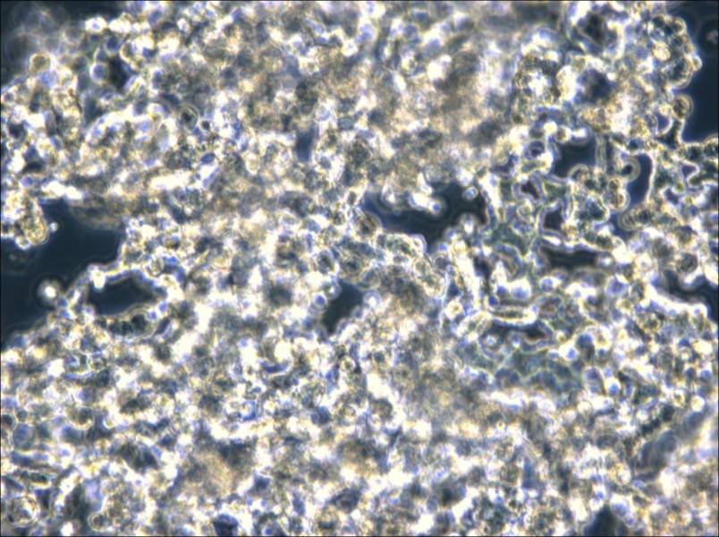 NCI-H526 Cell Complete Medium - small - 4