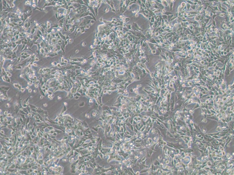 SNU-398 Cell Complete Medium - small - 8