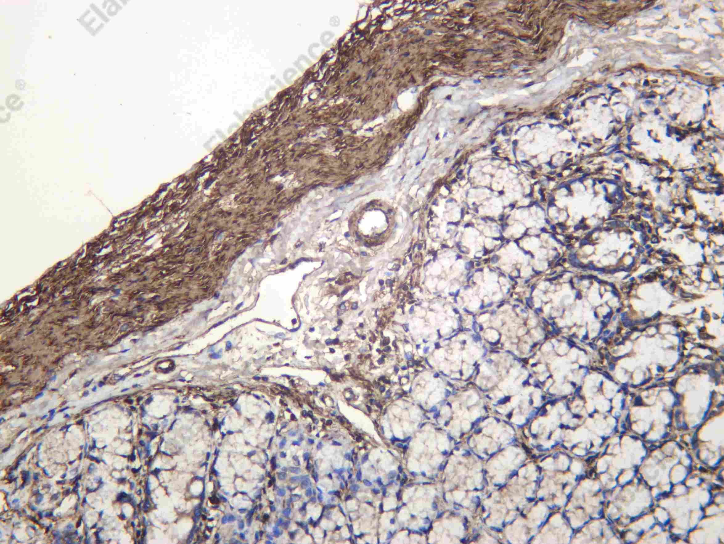 Recombinant ICAD Monoclonal Antibody - 4